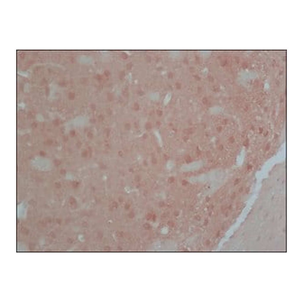 Merck Anti-Calcineurin (α-Subunit) antibody, Mouse monoclonal