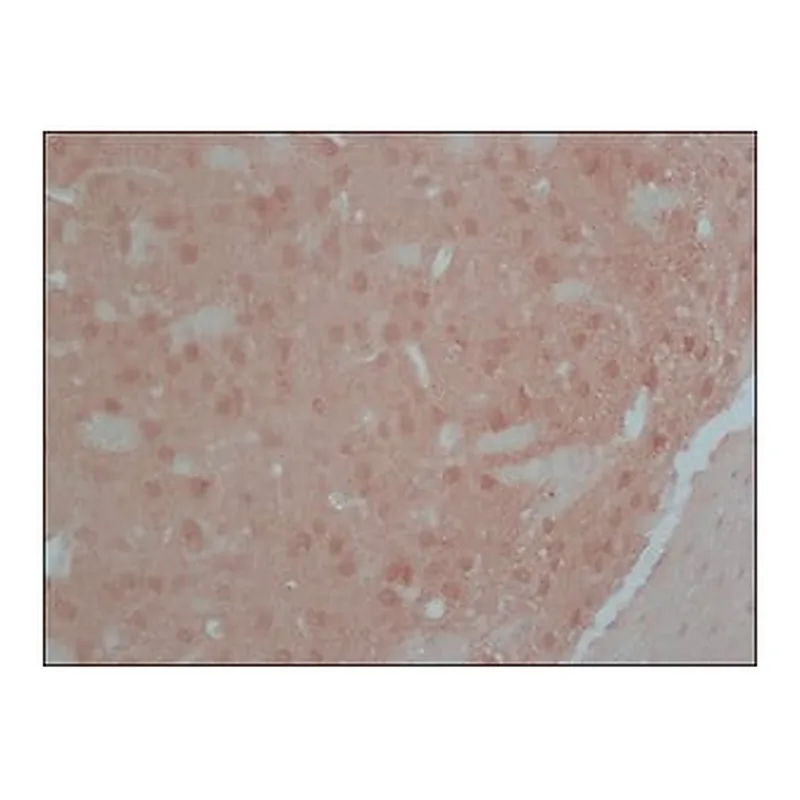 Merck Anti-Calcineurin (α-Subunit) antibody, Mouse monoclonal