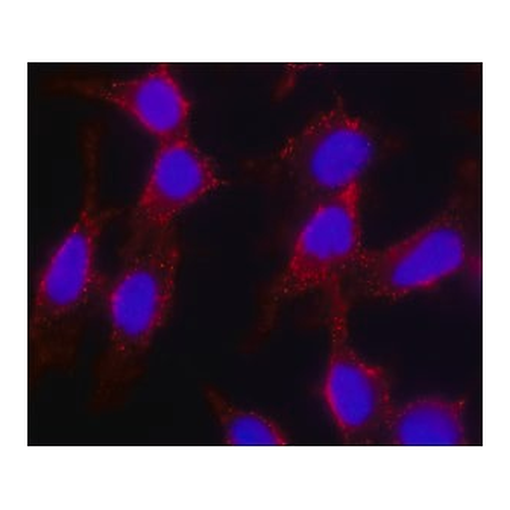 Merck Anti-Cholera toxin, B Subunit (CTxB) antibody, Mouse monoclonal