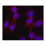 Merck Anti-Cholera toxin, B Subunit (CTxB) antibody, Mouse monoclonal