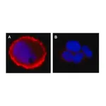 Merck Anti-phospho-erbB-2/HER-2 (Tyr1248) Antibody