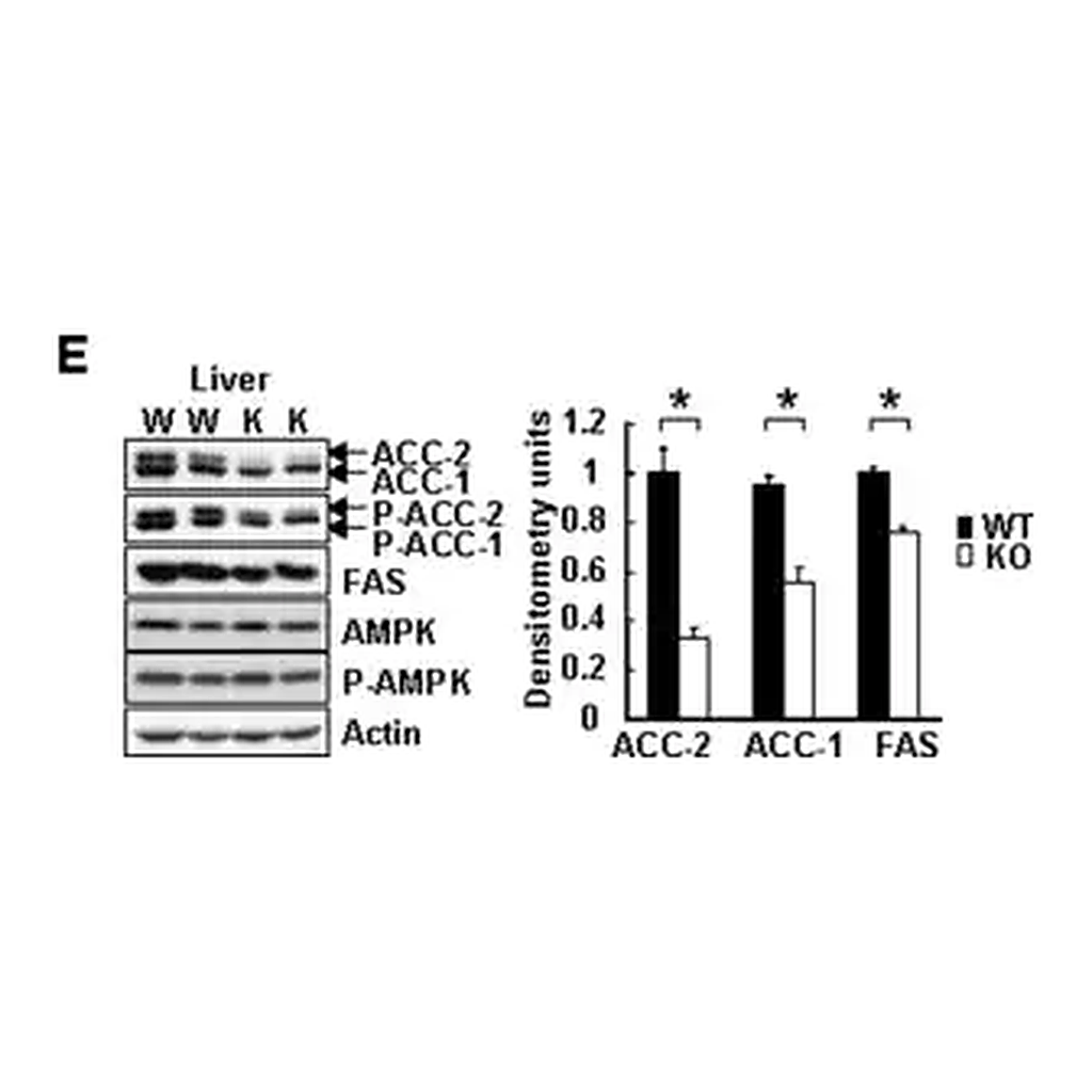 Merck Anti-phospho-Acetyl CoA Carboxylase (Ser79) Antibody
