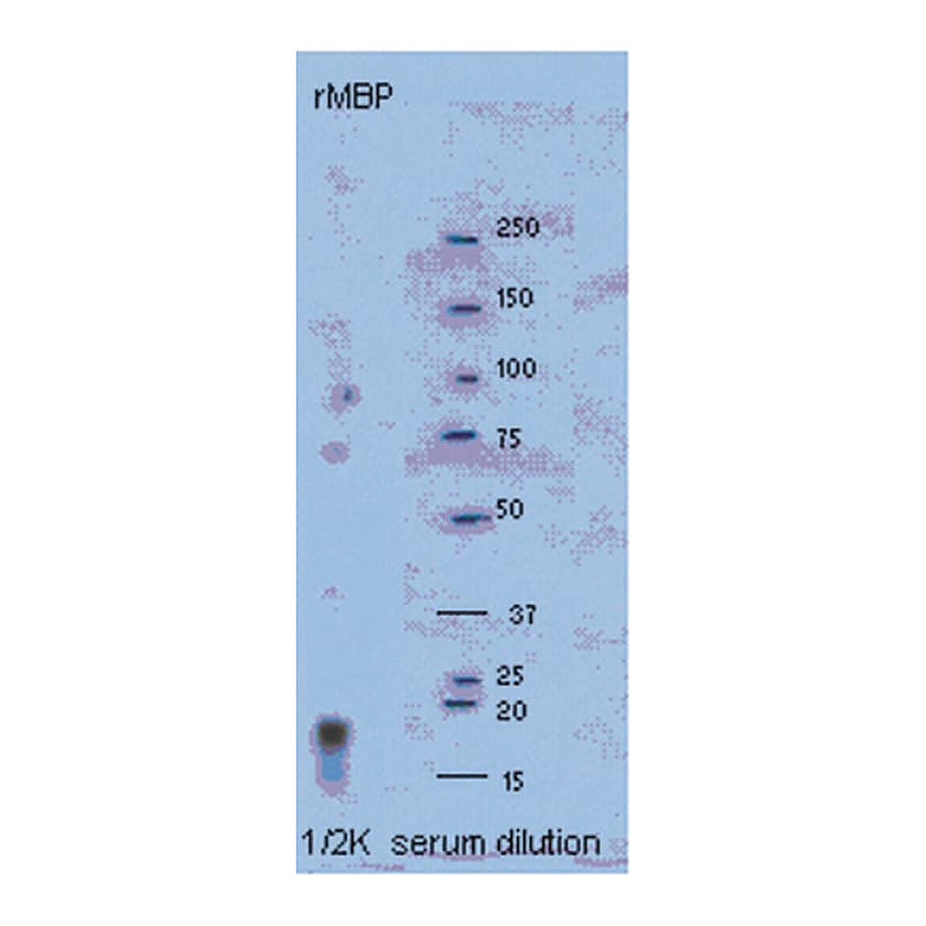 Merck Anti-Myelin Basic protein Antibody