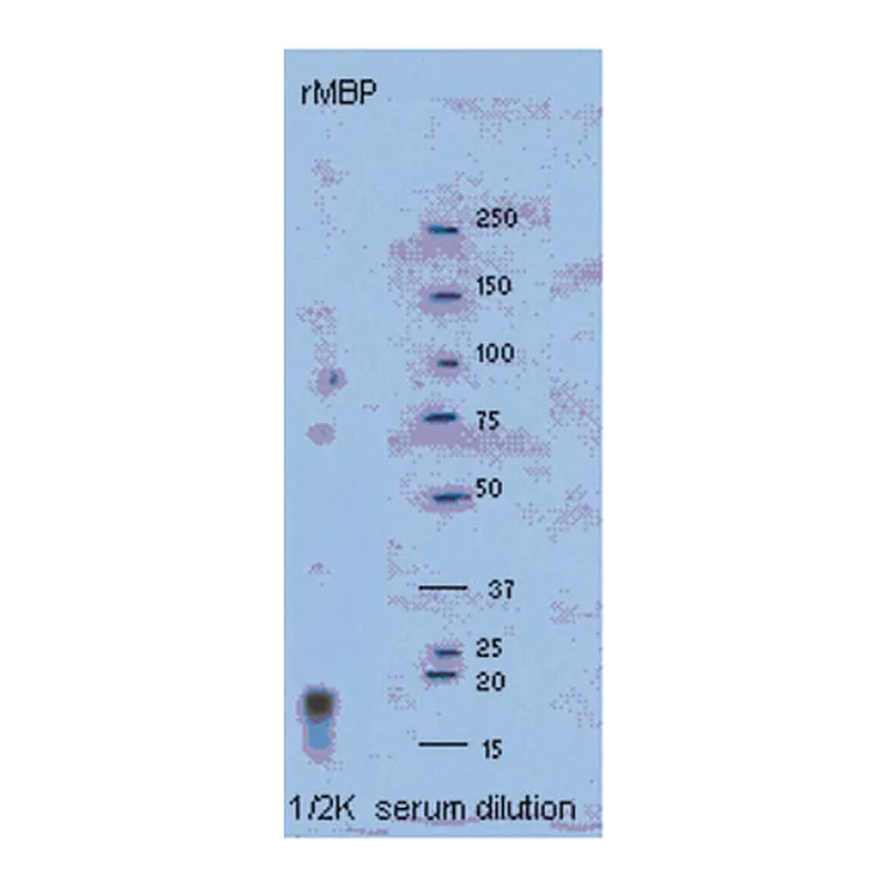 Merck Anti-Myelin Basic protein Antibody