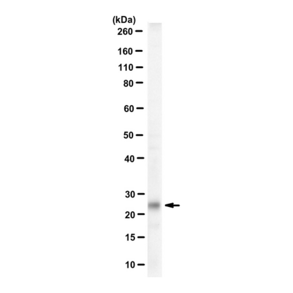 Merck Anti-Tentonin 3/TMEM150c