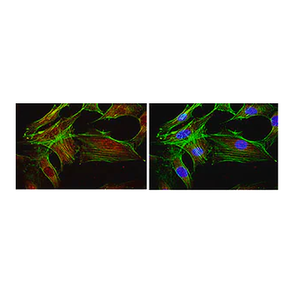 Merck Anti-FOXO1 Antibody, clone 2H8.2