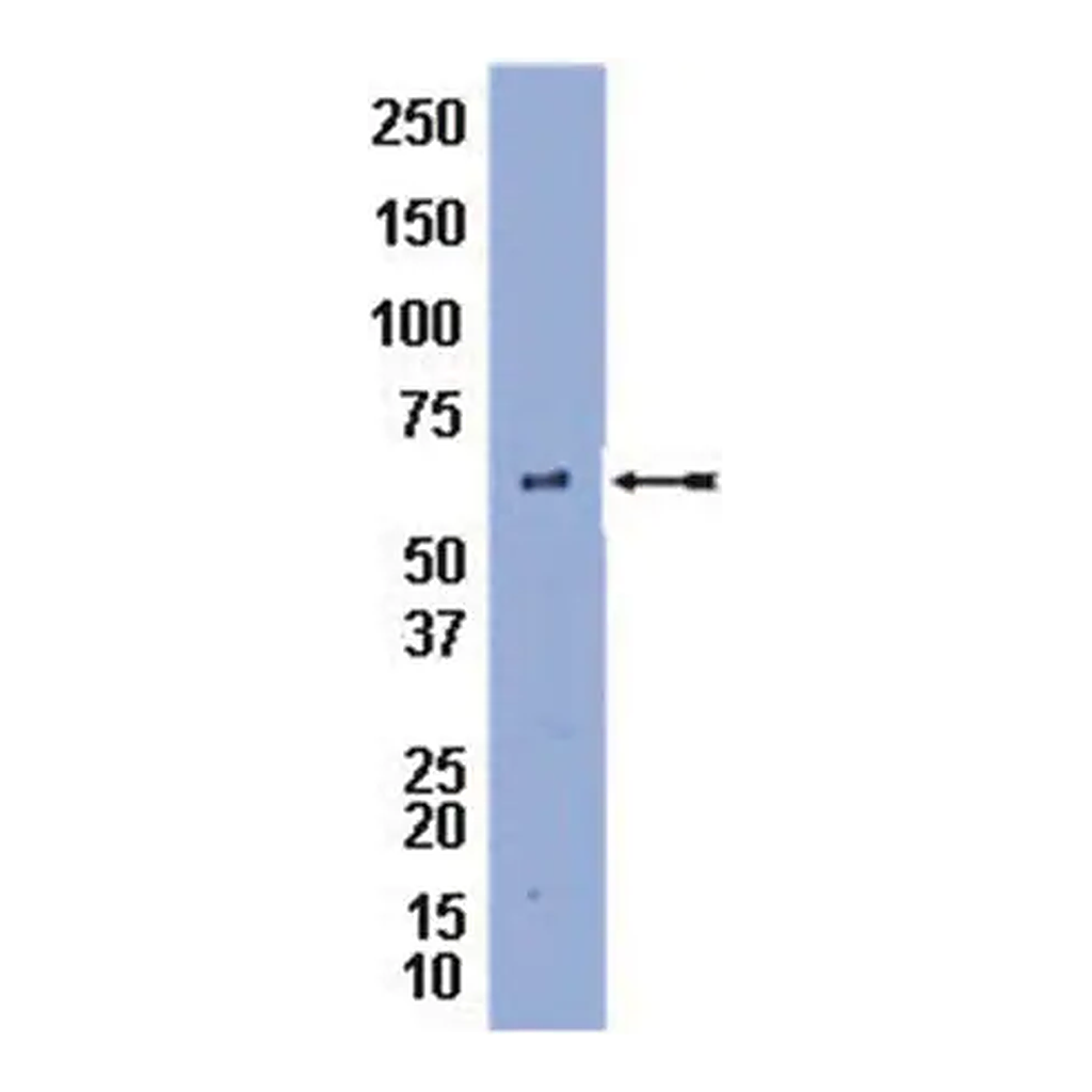 Merck Anti-Perilipin A Antibody