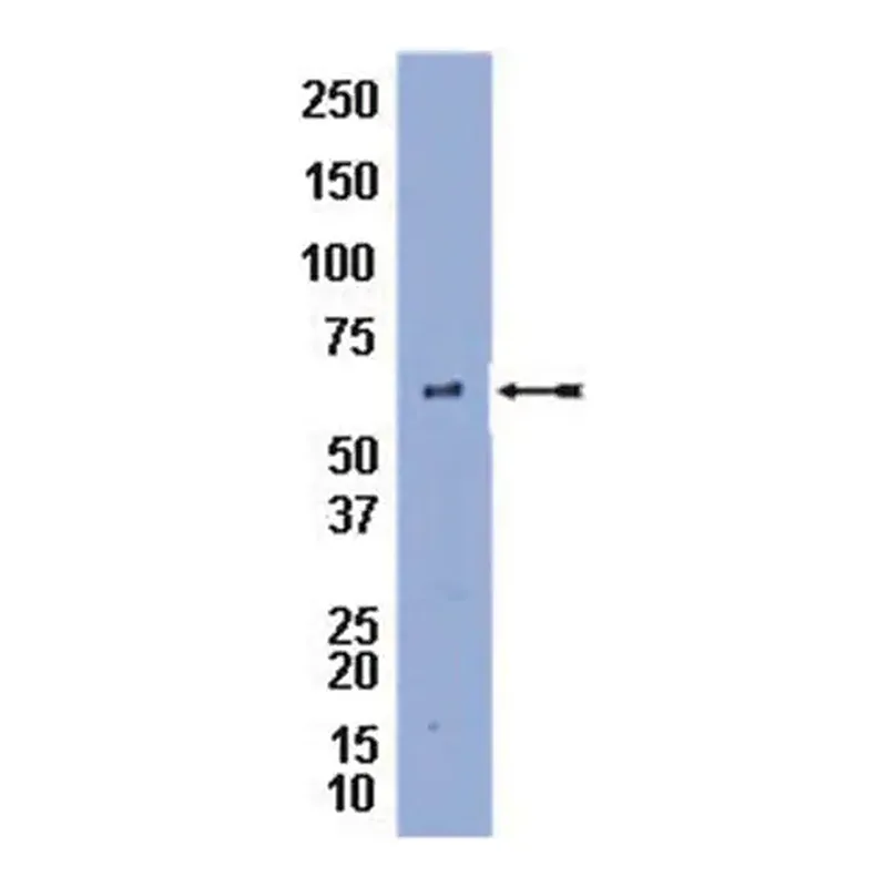 Merck Anti-Perilipin A Antibody