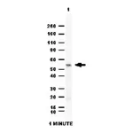 Merck Anti-Aldehyde dehydrogenase 1 (ALDH1A1) Antibody