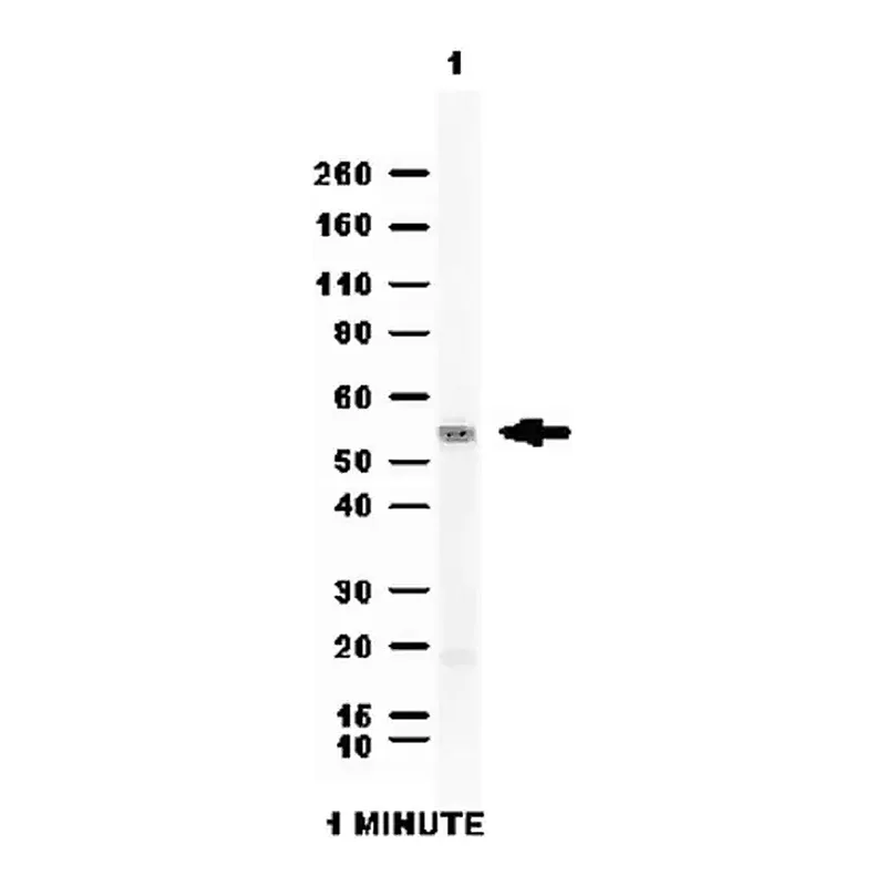 Merck Anti-Aldehyde dehydrogenase 1 (ALDH1A1) Antibody