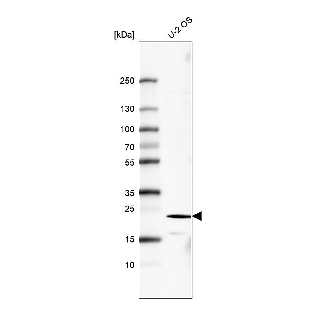 Merck Monoclonal Anti-FGF21 antibody produced in mouse