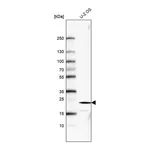 Merck Monoclonal Anti-FGF21 antibody produced in mouse