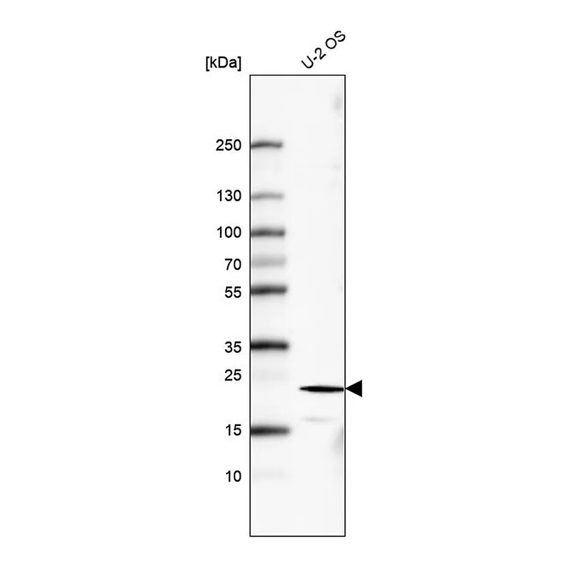 Merck Monoclonal Anti-FGF21 antibody produced in mouse