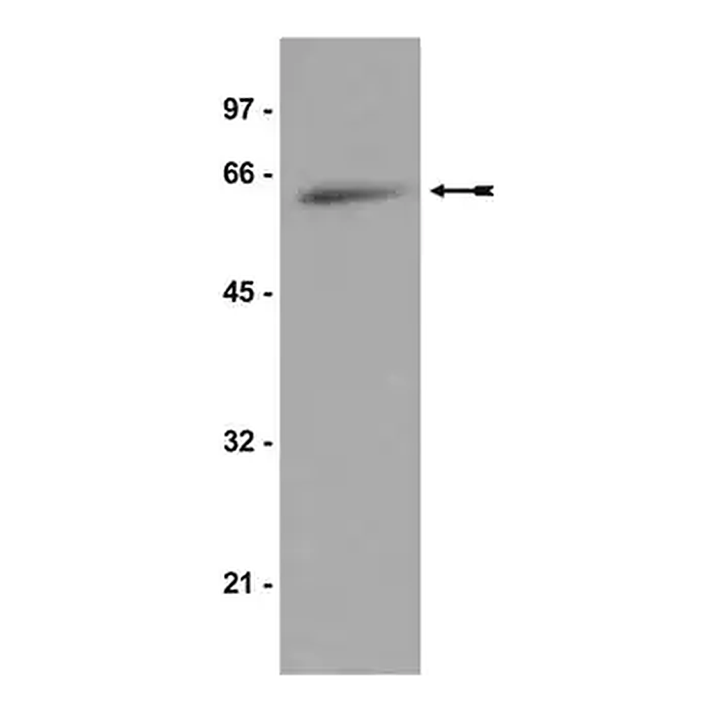 Merck Anti-p70 S6 Kinase Antibody