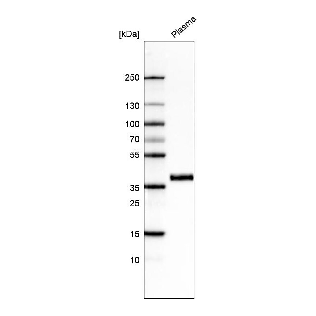 Merck Monoclonal Anti-INHBC antibody produced in mouse