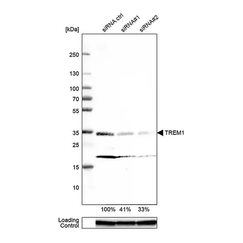 Merck Monoclonal Anti-TREM1 antibody produced in mouse