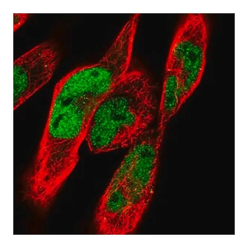 Merck Anti-CACUL1 antibody produced in rabbit