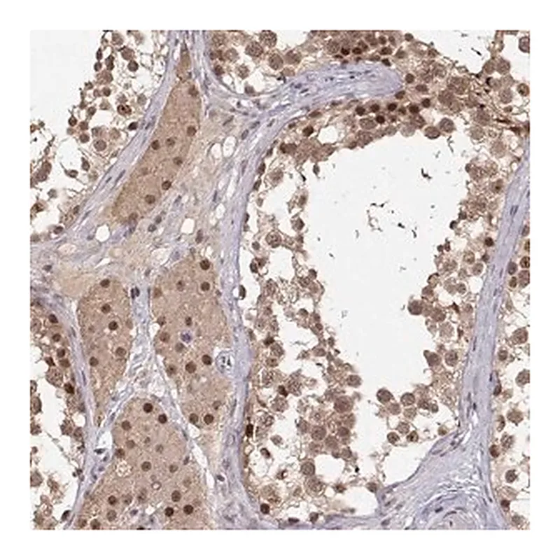 Merck Anti-CSNK2A1 antibody produced in rabbit