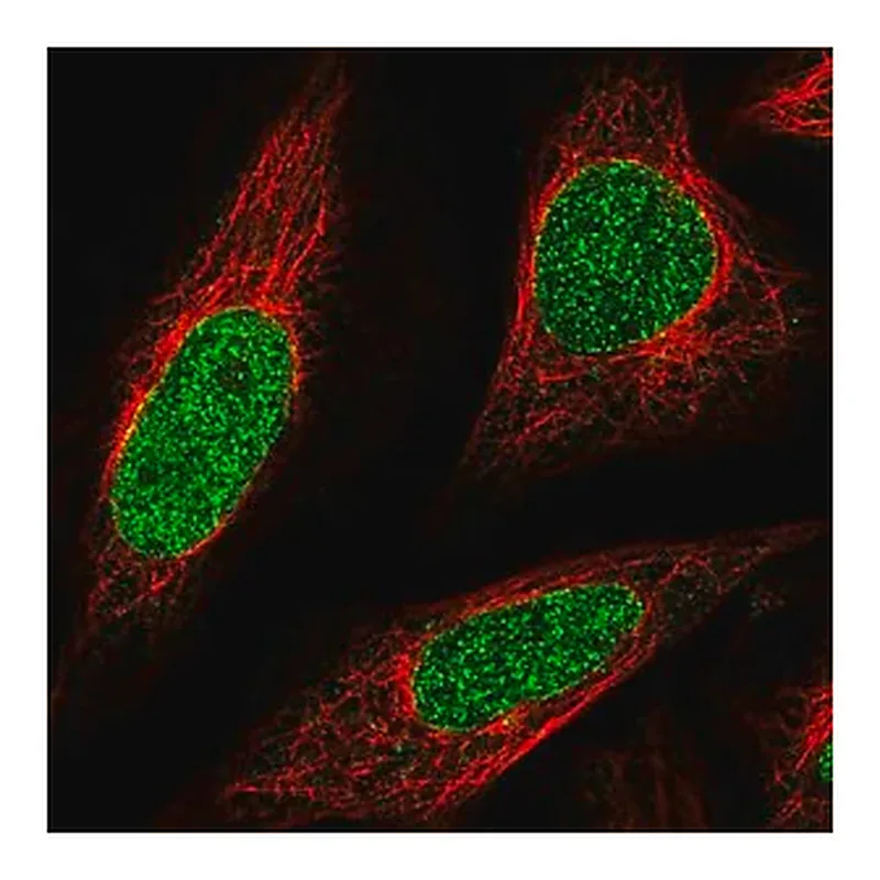 Merck Anti-ABCA5 antibody produced in rabbit