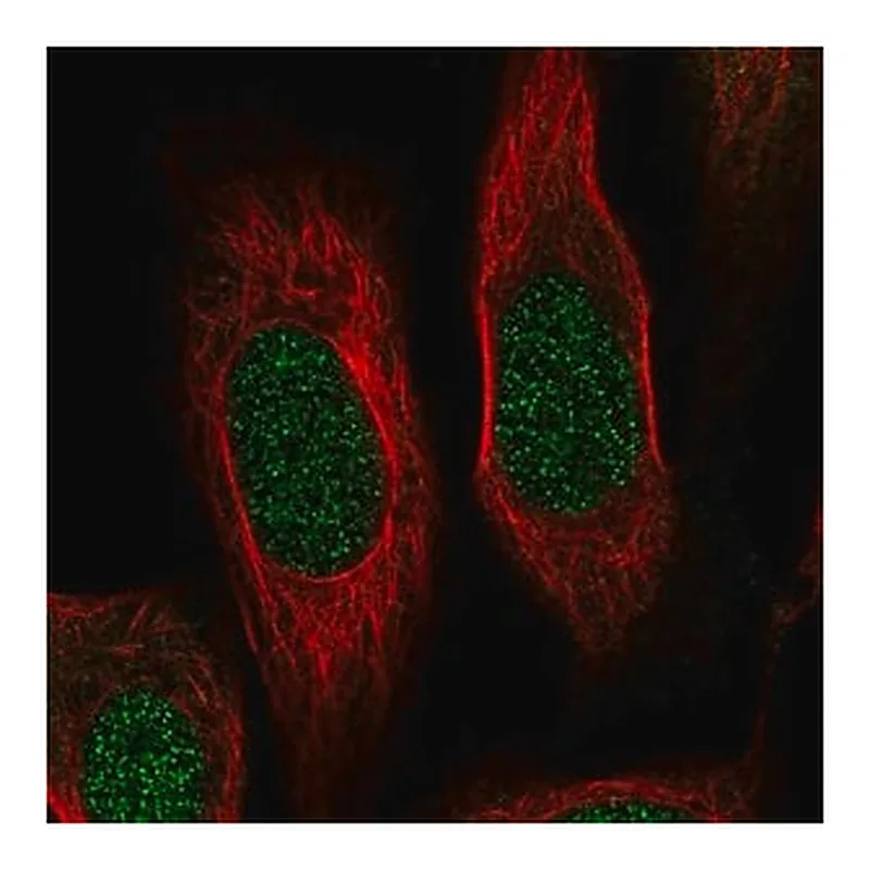 Merck Anti-RPS19 antibody produced in rabbit