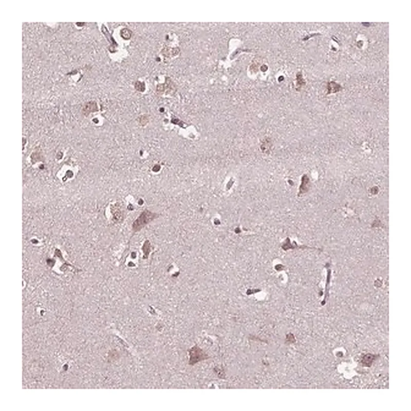 Merck Anti-CPT1C antibody produced in rabbit