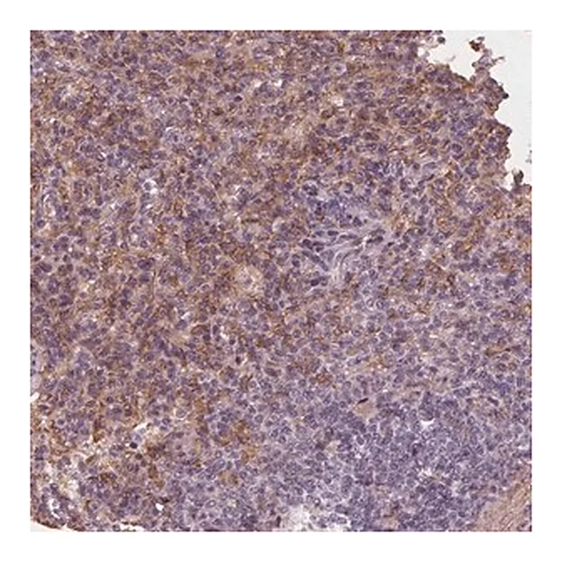 Merck Anti-IL9R antibody produced in rabbit