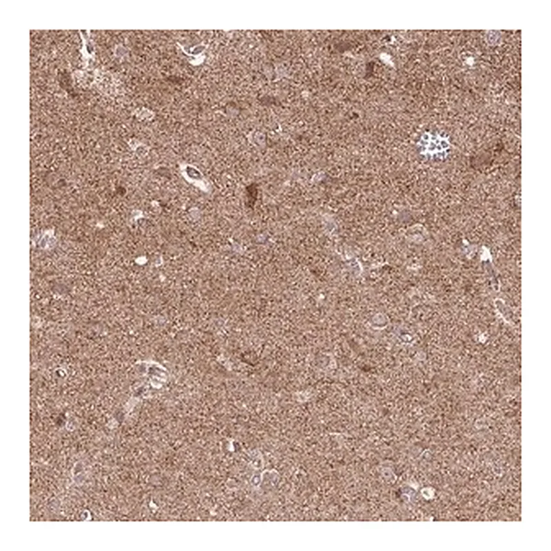Merck Anti-SPRED2 antibody produced in rabbit