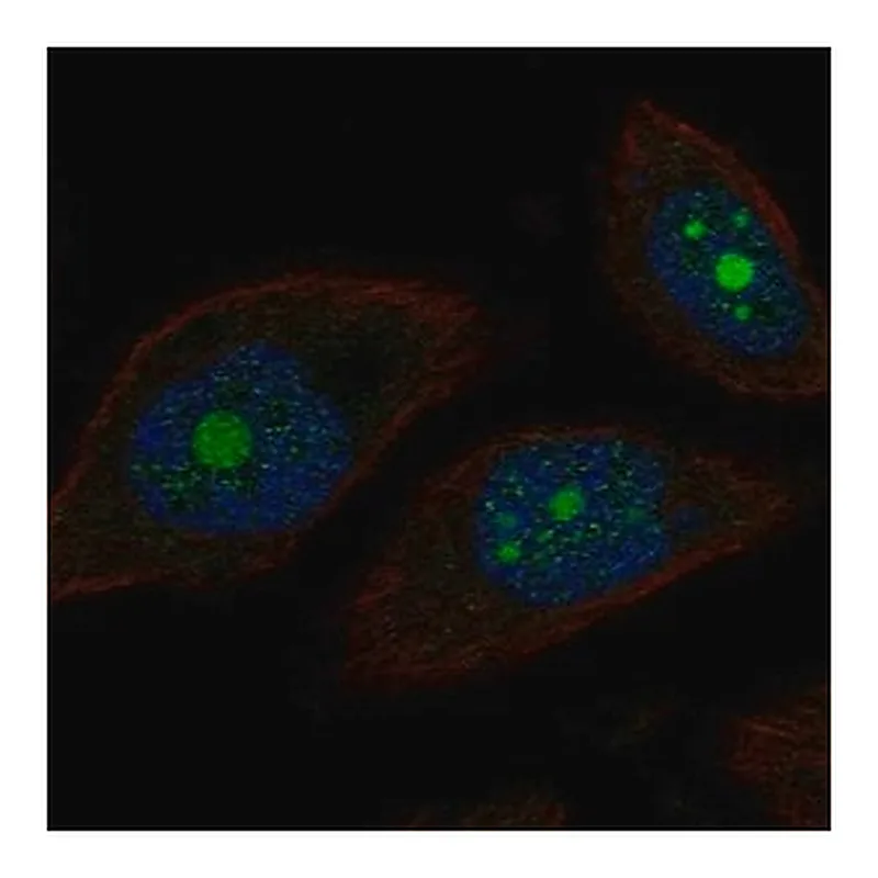 Merck Anti-POP1 antibody produced in rabbit