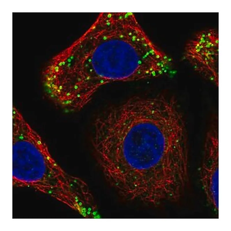 Merck Anti-CTDNEP1 antibody produced in rabbit