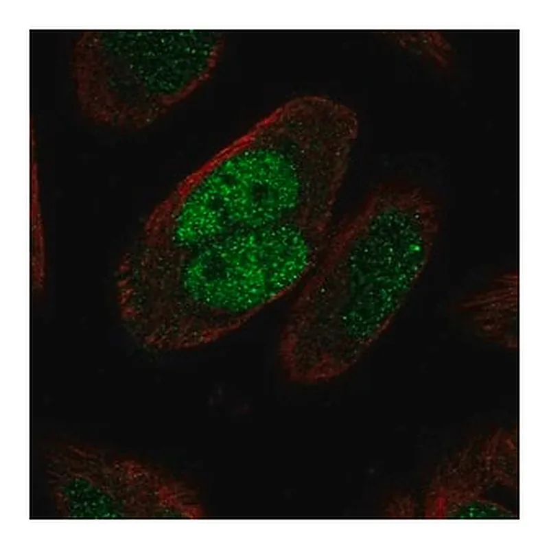 Merck Anti-MSH2 antibody produced in rabbit