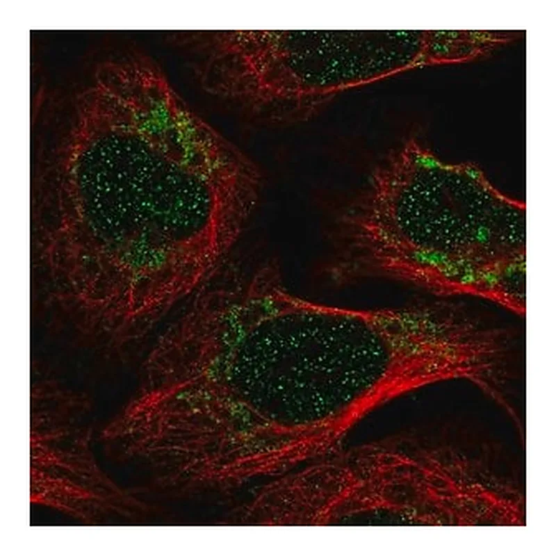 Merck Anti-PET100 antibody produced in rabbit