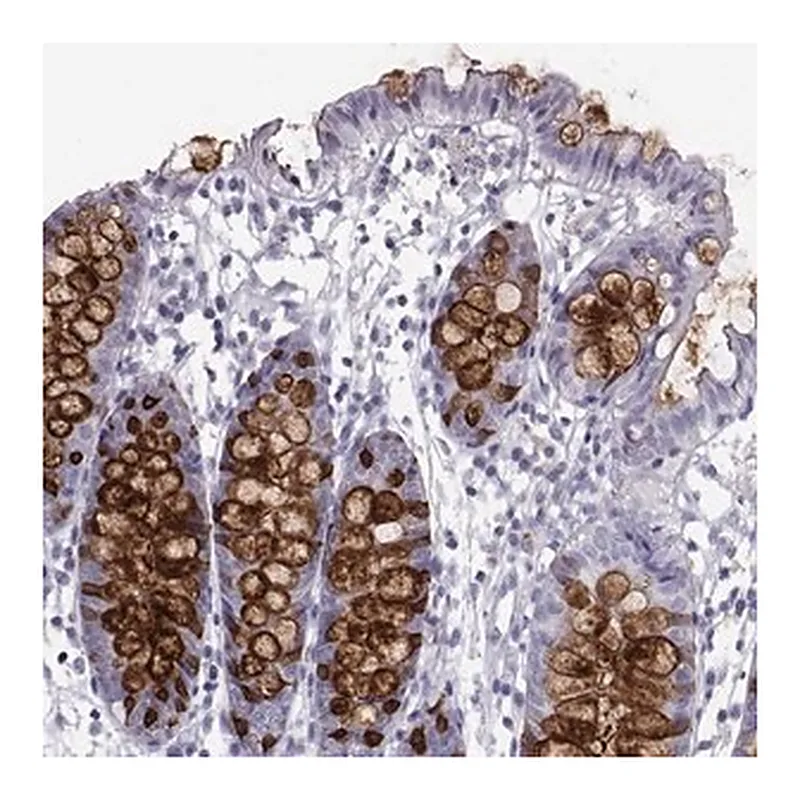 Merck Anti-ITLN1 antibody produced in rabbit