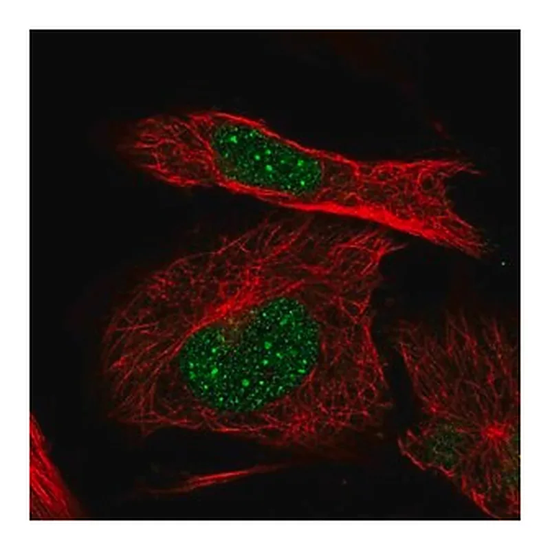 Merck Anti-ITGB1BP1 antibody produced in rabbit