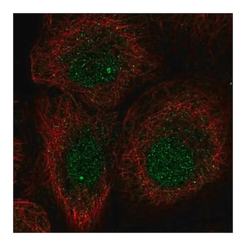 Merck Anti-L3MBTL1 antibody produced in rabbit