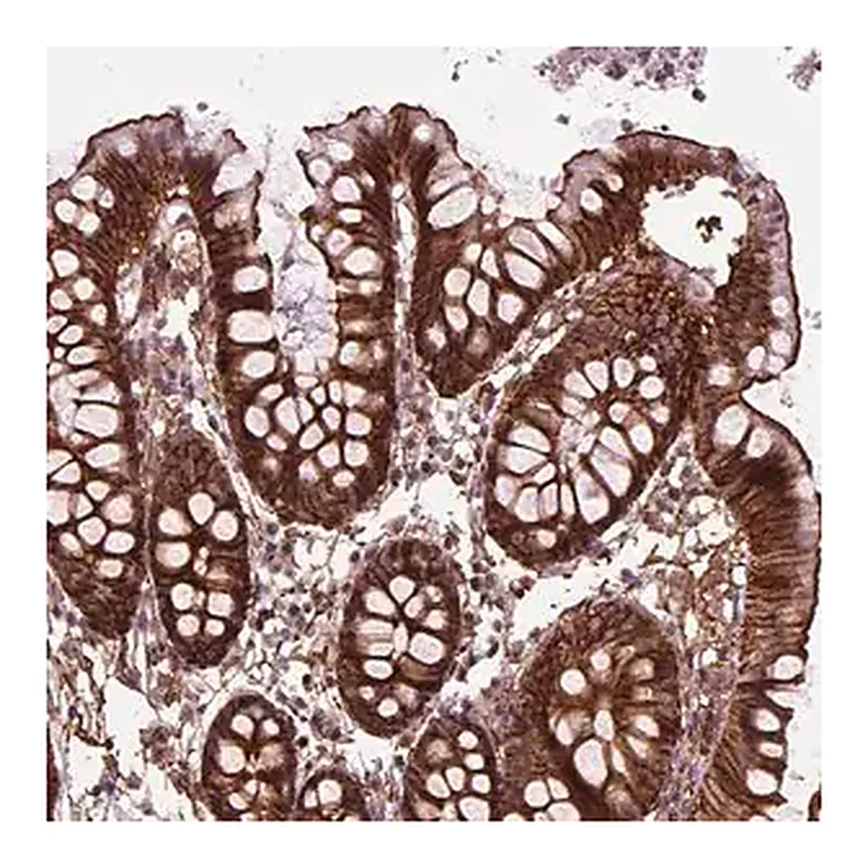 Merck Anti-MARCKS antibody produced in rabbit