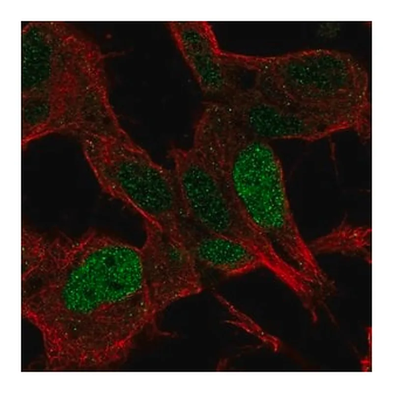 Merck Anti-SSBP2 antibody produced in rabbit