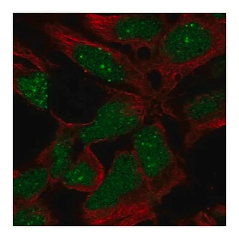 Merck Anti-RP11-302B13.5 antibody produced in rabbit