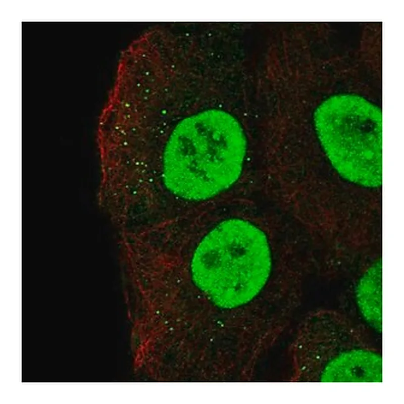 Merck Anti-MBD1 antibody produced in rabbit