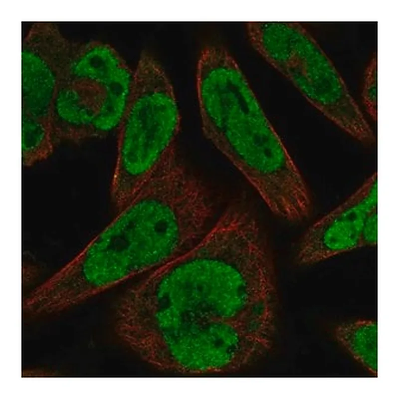Merck Anti-GLI1 antibody produced in rabbit