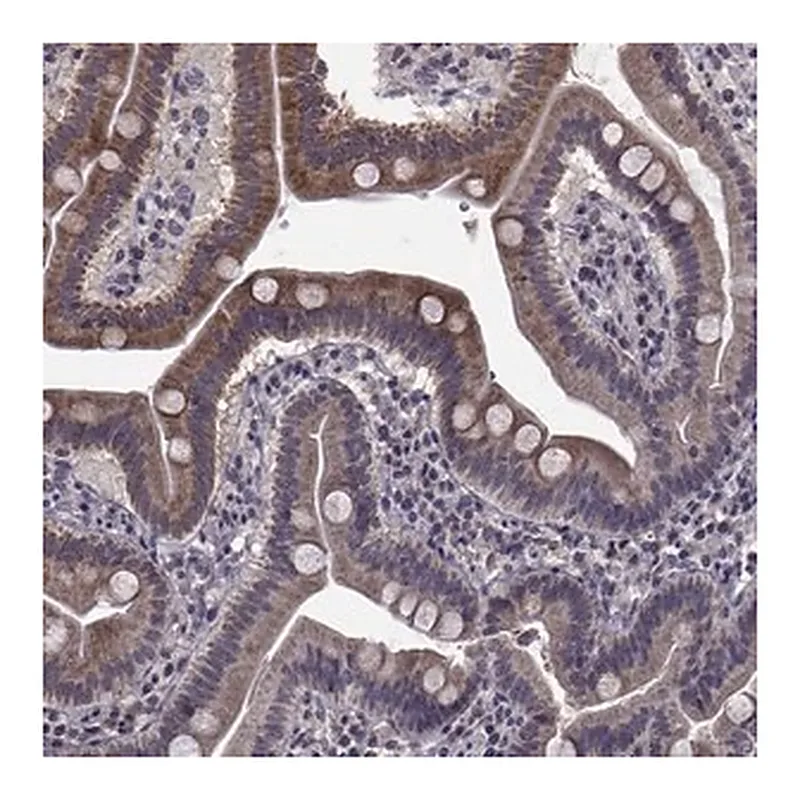 Merck Anti-CYP2S1 antibody produced in rabbit