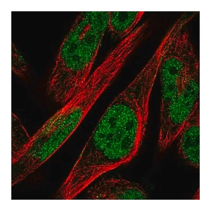 Merck Anti-ZNF594 antibody produced in rabbit