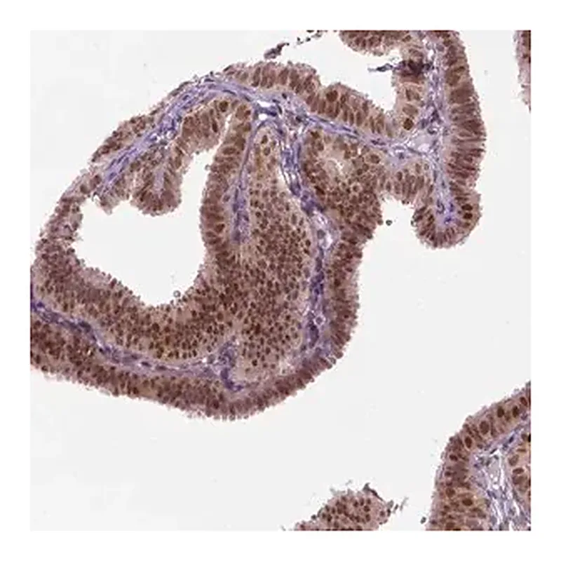 Merck Anti-MGMT antibody produced in rabbit