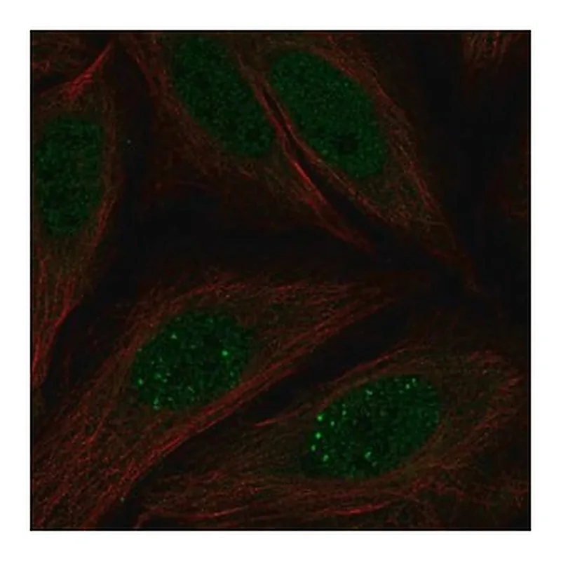 Merck Anti-MKNK2 antibody produced in rabbit
