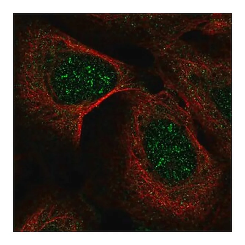 Merck Anti-IP6K2 antibody produced in rabbit