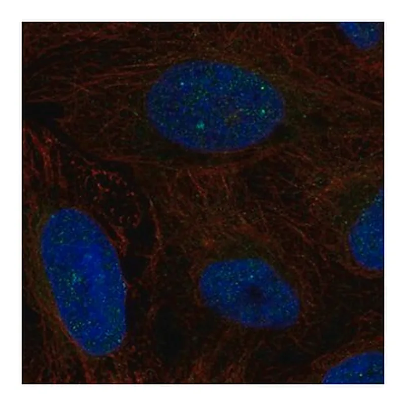 Merck Anti-ERCC6 antibody produced in rabbit
