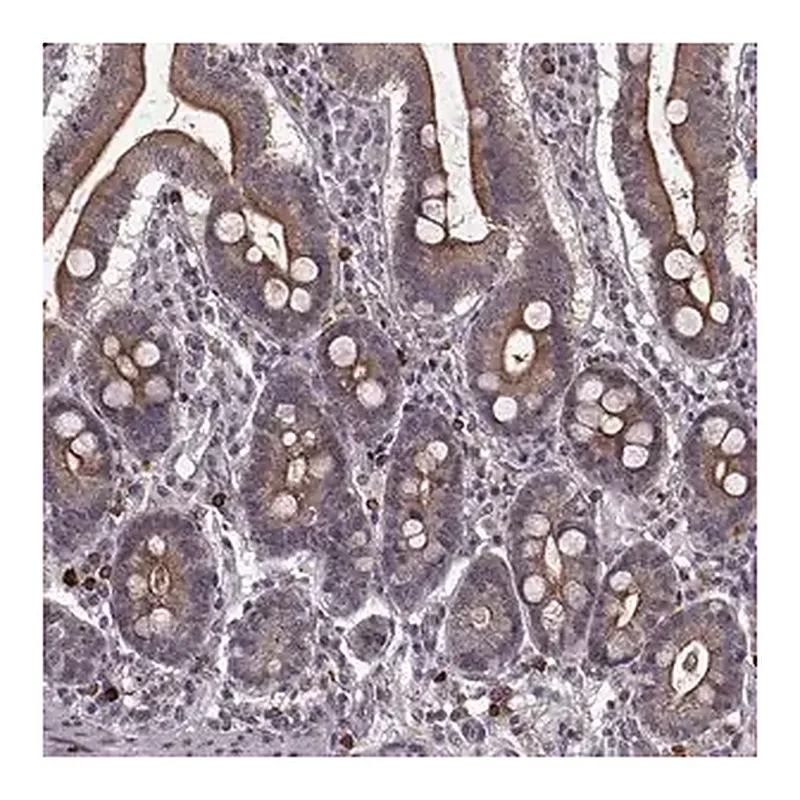Merck Anti-DENND4B antibody produced in rabbit
