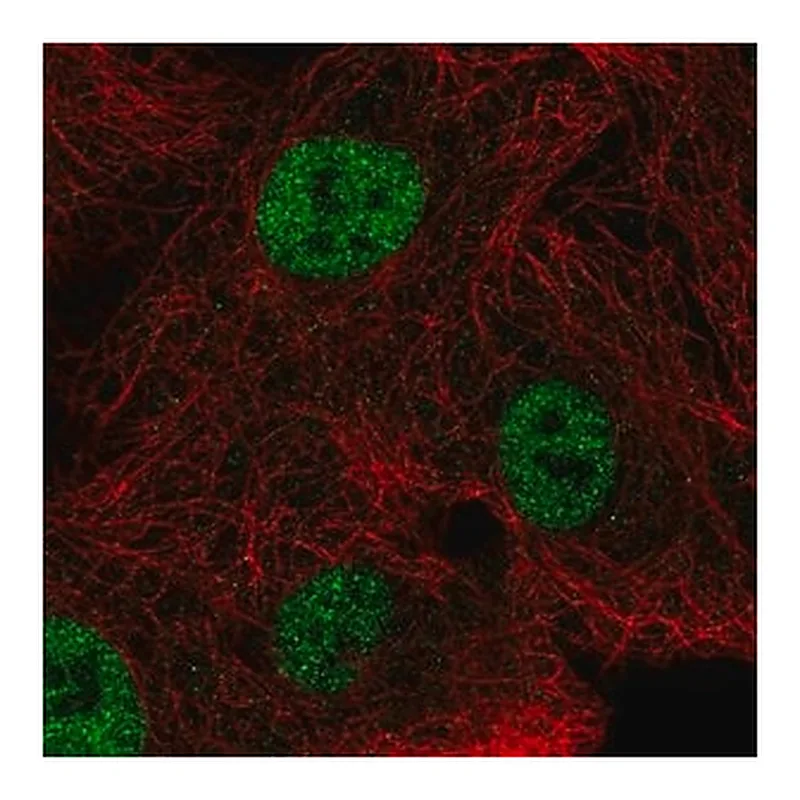 Merck Anti-NEIL2 antibody produced in rabbit