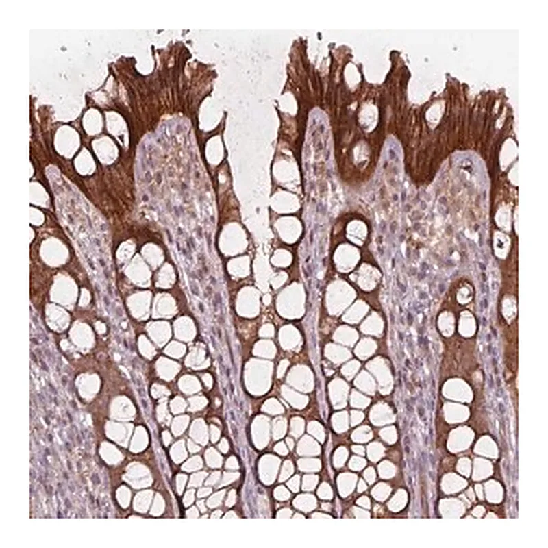 Merck Anti-CHMP3 antibody produced in rabbit