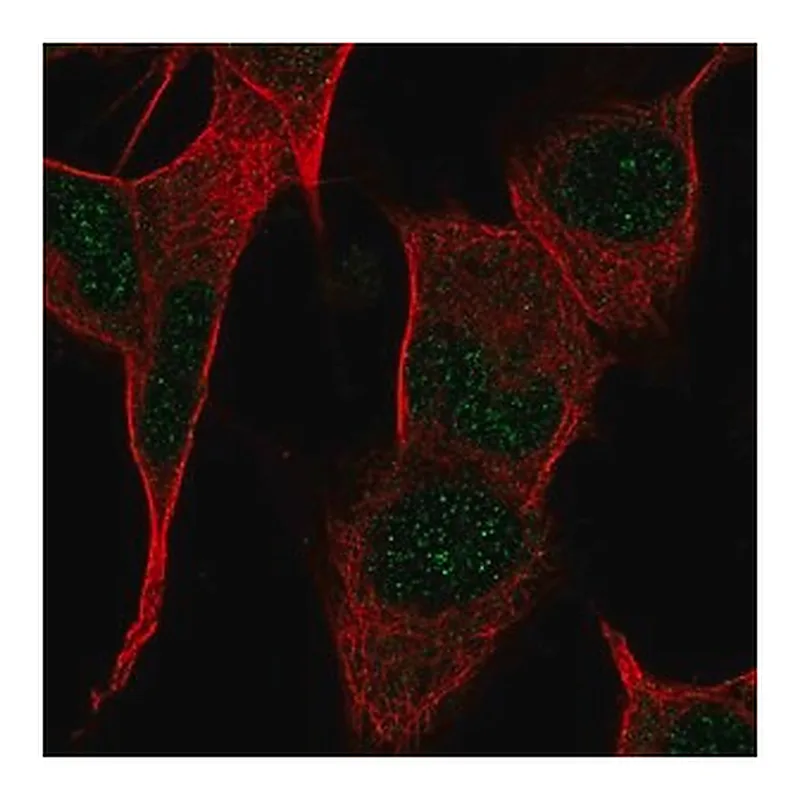 Merck Anti-PPP1R17 antibody produced in rabbit