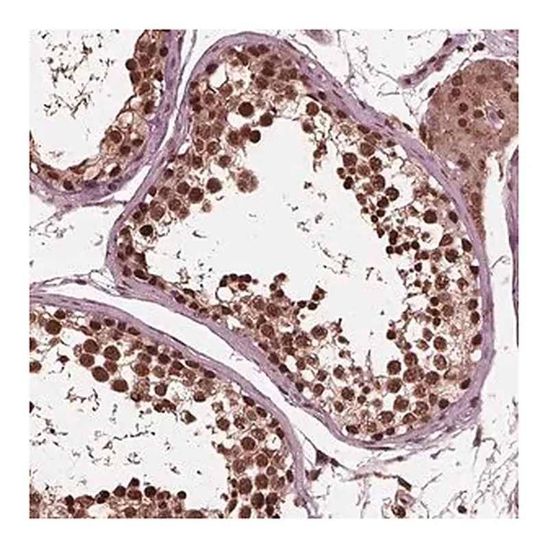 Merck Anti-NSD1 antibody produced in rabbit